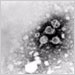 Transmission electron micrograph of hepatitis B virions