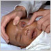 Infant with meningococcal endophthalmitis