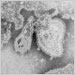 Electron micrograph of the mumps virus