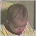 Infant with pertussis cough, #3