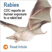 Rabies: CDC reports on human exposures to a rabid bat