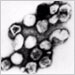 Transmission electron micrograph of rubella virus
