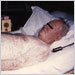 Bedridden, elderly man with chickenpox