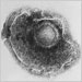Electron micrograph of a Varicella (Chickenpox) Virus