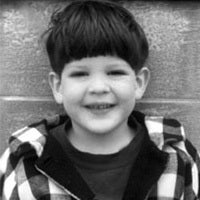 Three-year-old Leo Wexler after his ordeal with severe pneumococcal disease.